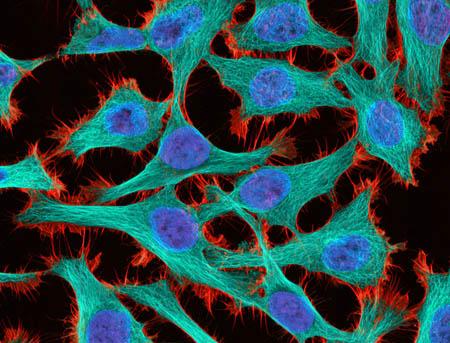 HeLa Cells