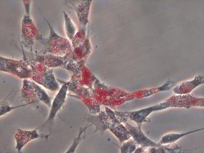 Matrix Stiffness Essential to Stem Cell Differentiation (2 of 3)