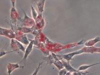 Matrix Stiffness Essential to Stem Cell Differentiation (2 of 3)