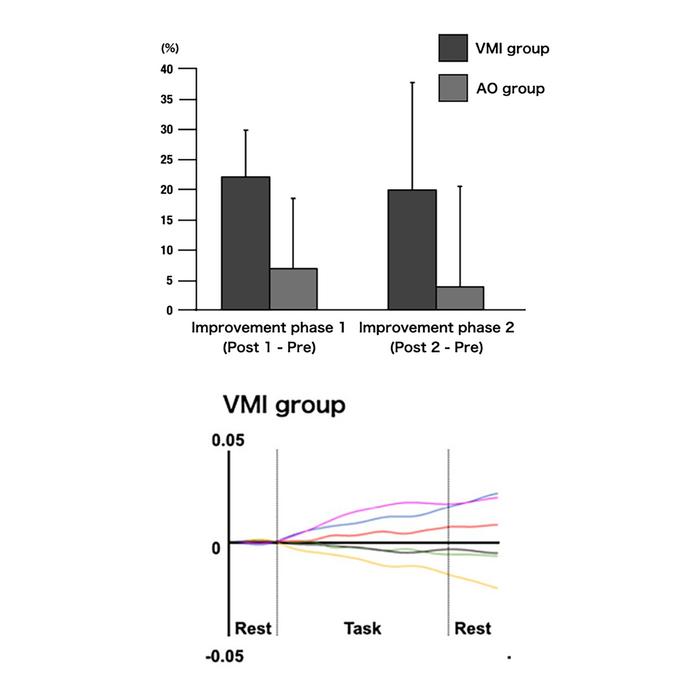 Differences between VMI and AO.