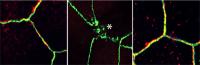 Metformin Acting on Gut Organoid, University of California San Diego