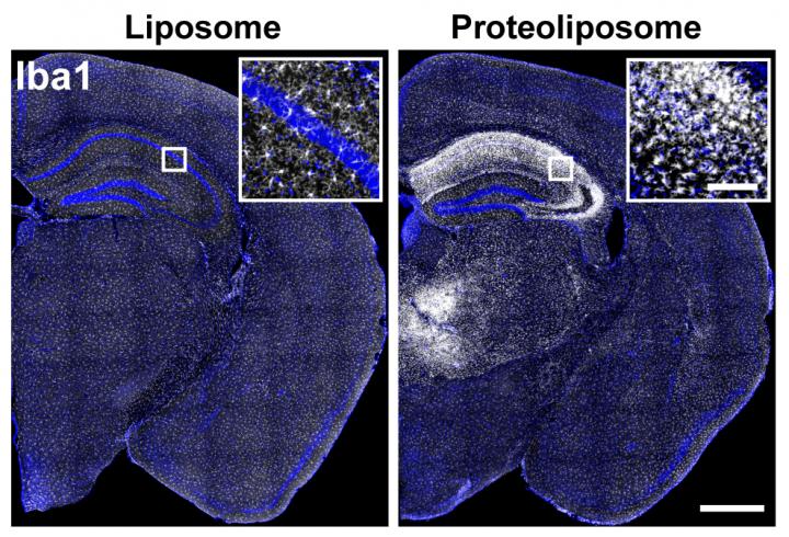 Building Better Mouse Models for Autoimmune Encephalitis (1 of 2)