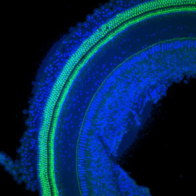 Cochlear Coils