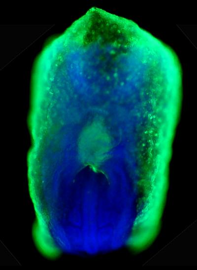 A Trio of Signals Converge to Induce Liver and Pancreas Cell Development