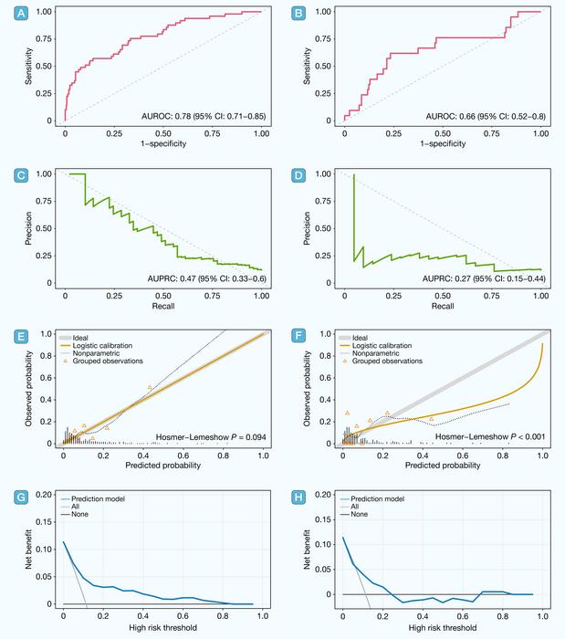 Receiver operating characteristic (ROC) curves, precision-recall (PR) curves, calibration curves, and decision-curve analysis (DCA) for the training set and validation set.