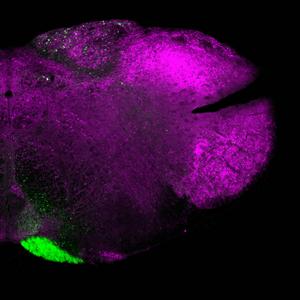 Brain microscopy