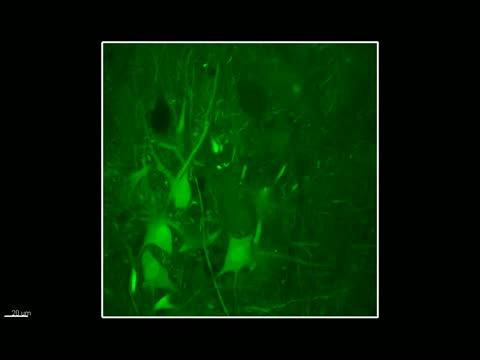 A New Vector for Gene Transfer across the Blood Brain Barrier
