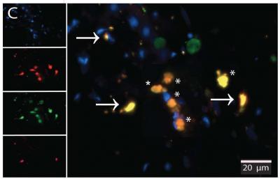 ALS Macrophages