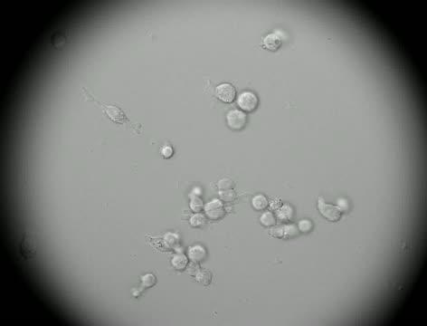 Cytokinetic Defect and Apoptosis of T4Cytokinetic Defect and Apop7D Cells Caused by OTS964 Treatment