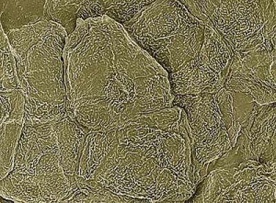 Keratinocytes