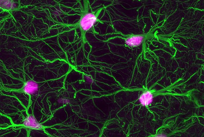 Support cells in the brain called astrocytes (green) increase their levels of STAT3 activation (pSTAT3, magenta) in a mouse model of dementia.