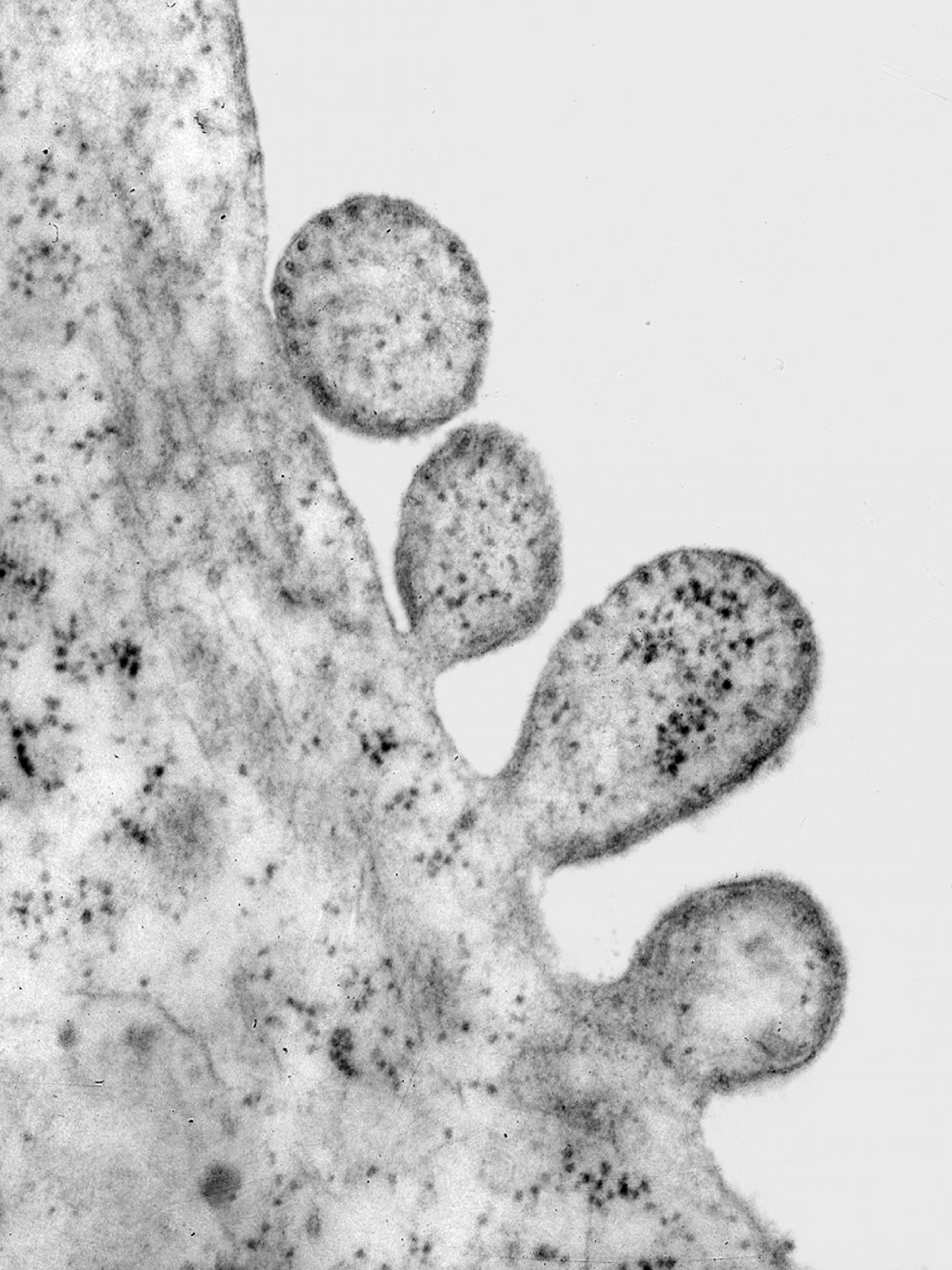 Bacteria