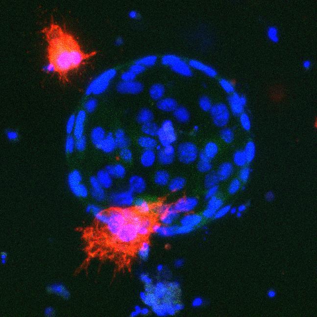 Organoid in Stroma