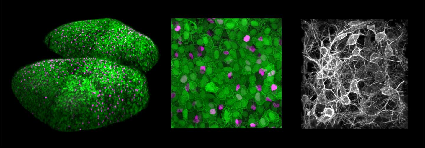 Imagerie intravitale des cellules souches neurales dâ€™un poisson zÃ©brÃ© pendant 23 jours 