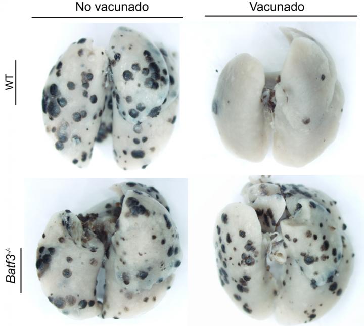 Lung Metastases
