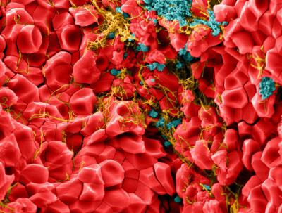 Blood Polyhedrocytes