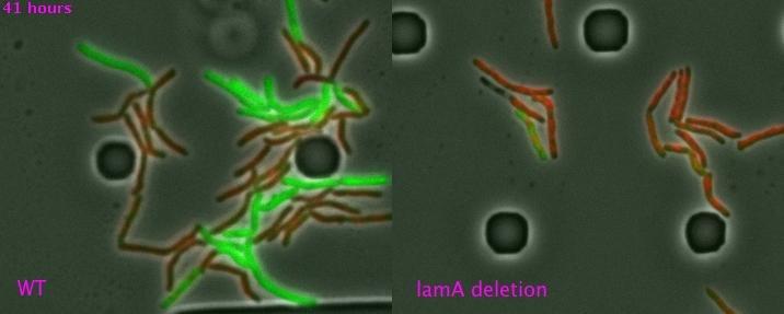 Mycobacteria With and Without lamA Gene