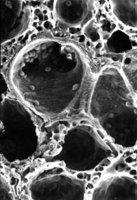 Blood Vessel