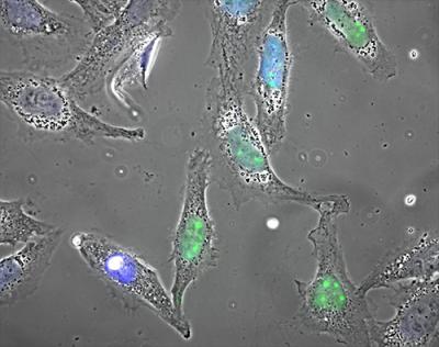 Cells Under Stress