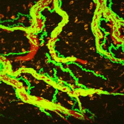 Creeping T-cells