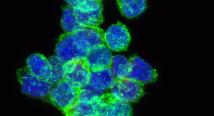 'Switchable' CAR T cells