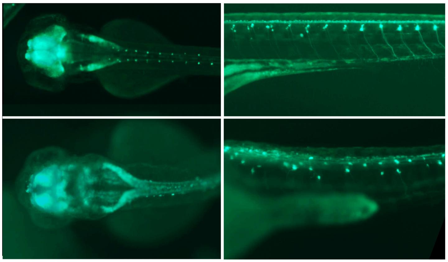 Fluorescence image