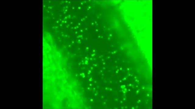 Reelin Promotes Artery Plaque Buildup (2 of 3)
