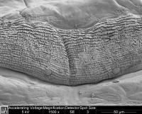 Midge Patch 1500x