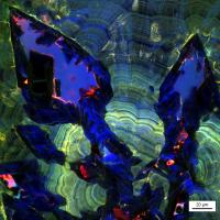 Micrograph (2 of 2)