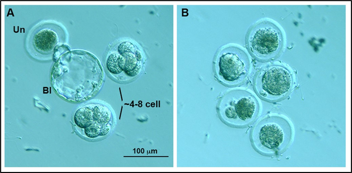New study sheds light on how an autoimmune disorder may underlie male infertility