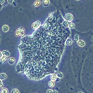Embryonic stem cells