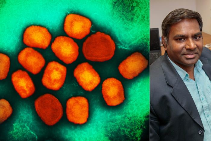 Mpox virus composite with researcher Vaithi Arumugaswami