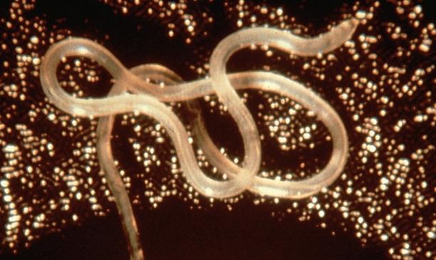 Adult <i>Loa loa</i> Worm