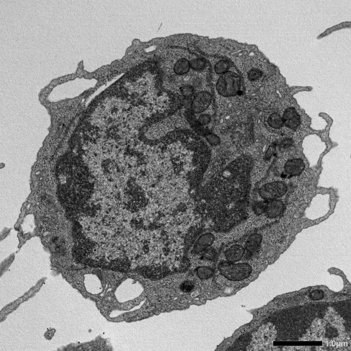 MLKL-Dependent Mitochondrial Changes in Aged Hematopoietic Stem Cells