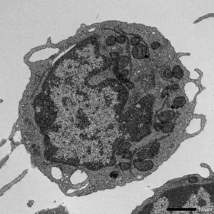 MLKL-Dependent Mitochondrial Changes in Aged Hematopoietic Stem Cells