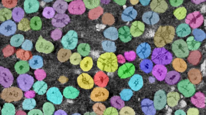 Battery cathode particles identified by computer vision