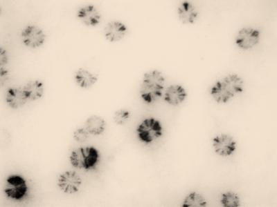 Mycoplasms
