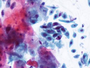 Human vaginal microbiome is shaped by competition for resources
