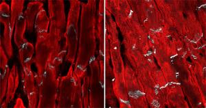 Composite Muscle Cells
