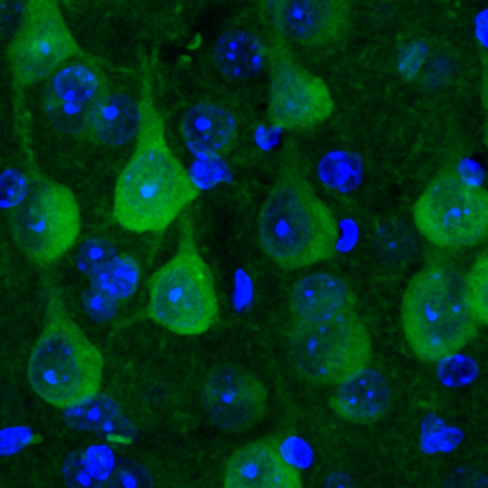 Proteostasis sensor
