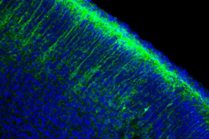 Elevated ASNS on neurons in Angelman syndrome