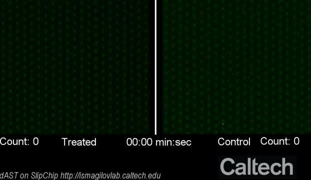 Antibiotic Susceptibility Testing in 30 Minutes or Less May Help Doctors...