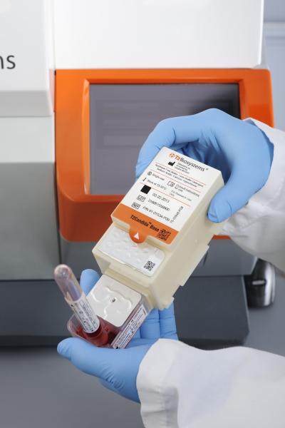 New Blood Test Detects Common Fungal Infection (1 of 3)