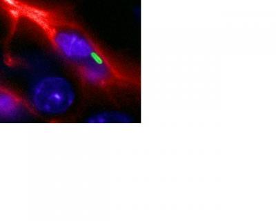 A Cell Infected by Salmonella
