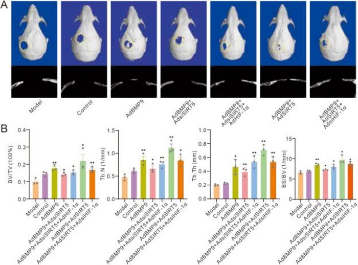 Effects of SIRT5 and/or HIF-1α on BMP9-induced bone defect repair.