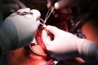 Cardiac surgeons