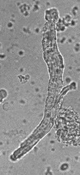 How do Pacemaker Cells in the Heart and Gut Generate Electrical Signals? (1 of 1)