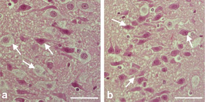 High power light microscopic images of hippocampus