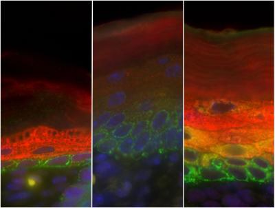 Skin Cell Differentiation