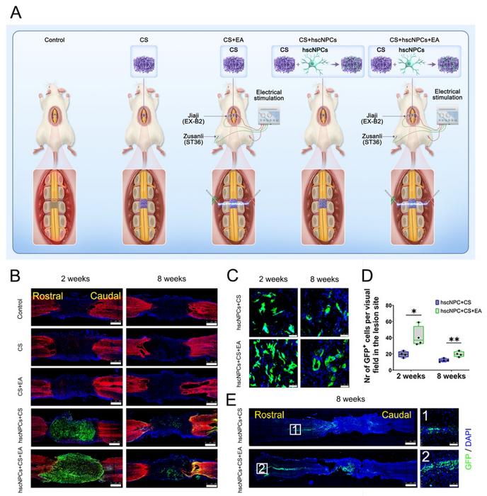 Electroacupuncture Combined with Spinal Neural Cell Transplantation Synergistically Promotes Nerve Regeneration and Functional Rehabilitation After Spinal Cord Injury
